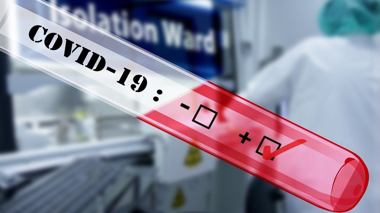 CBD Covid-19 Zytokinstürme